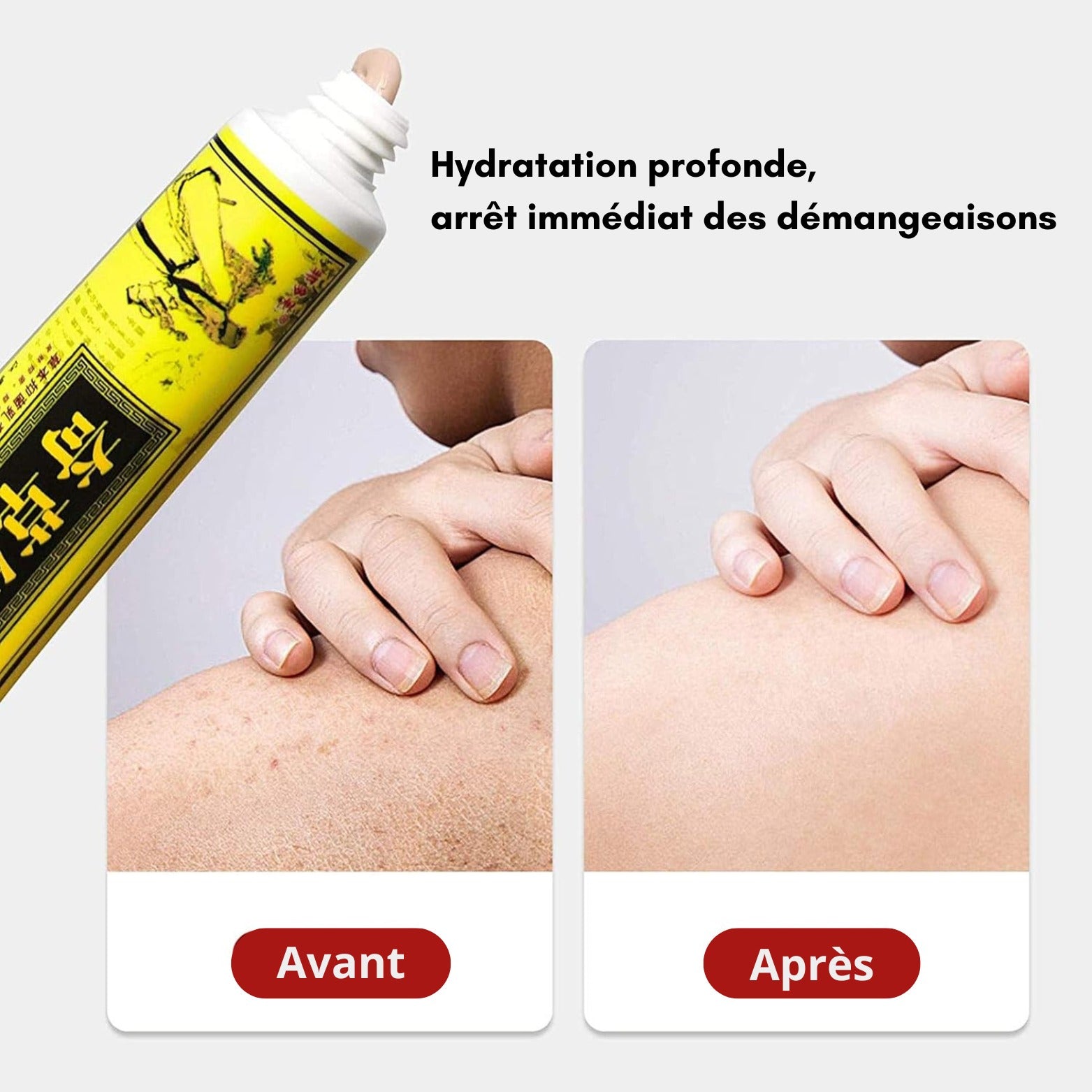 🌿 Purherb – Crème Naturelle Contre l’Eczéma et le Psoriasis